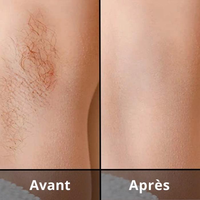 Épilateur IPL Lumière Pulsée Arya Lush